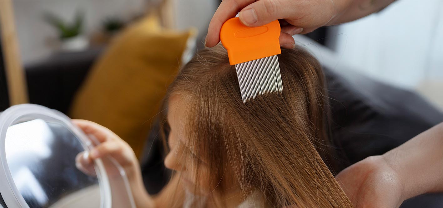 Cómo eliminar piojos y liendres: guía completa para tratar la pediculosis