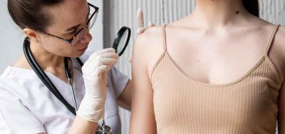 Cáncer de piel: síntomas, causas y prevención